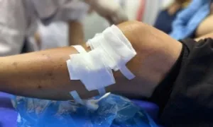 Cụ bà bị đàn chó becgie tấn công